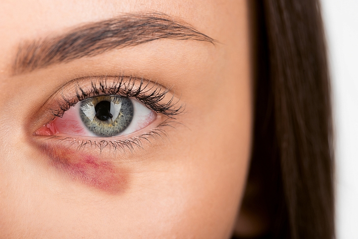 Изображение к статье