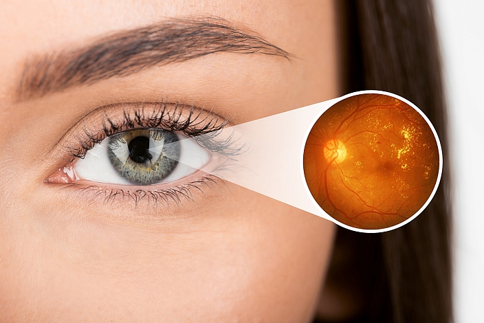 Изображение к статье